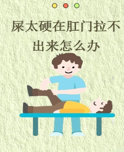 便便卡怎么用