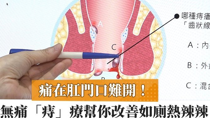 便荔卡提现怎么处理